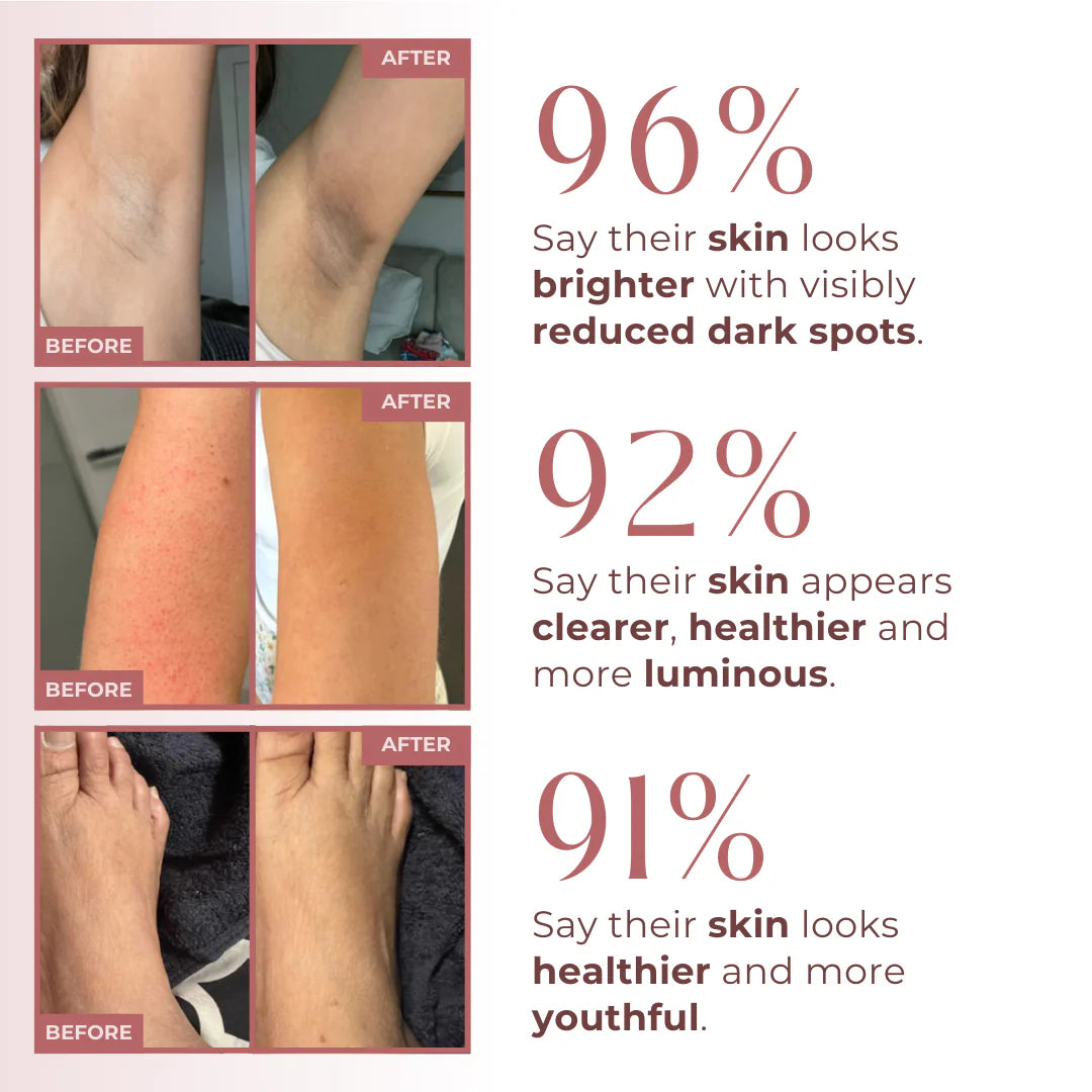 Vitalizees Peel Shot - Kojic + Turmeric Body Peel Spray