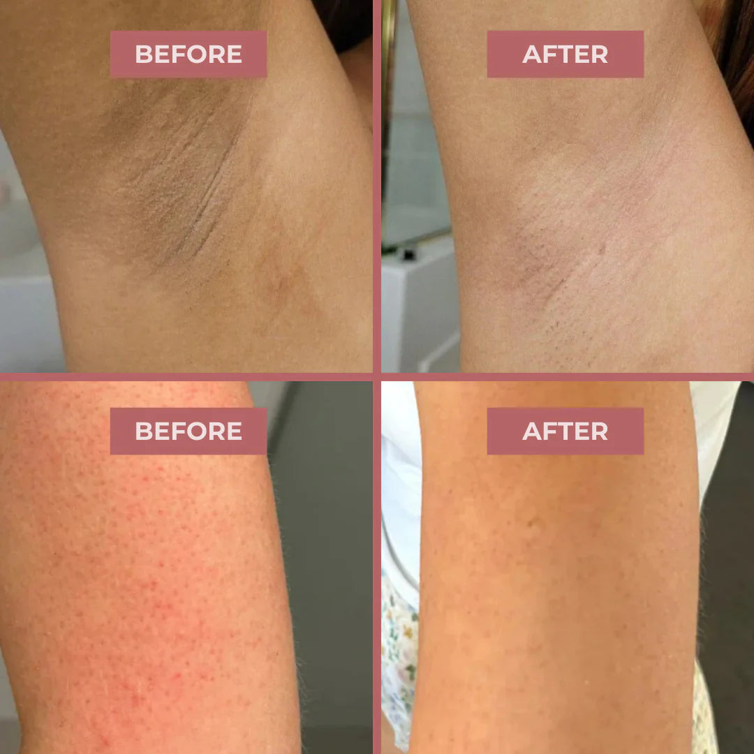Vitalizees Peel Shot - Kojic + Turmeric Body Peel Spray